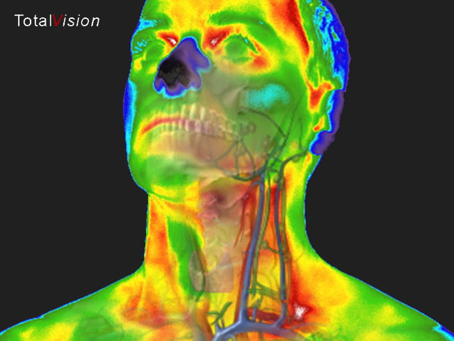 medische_thermografie_nek