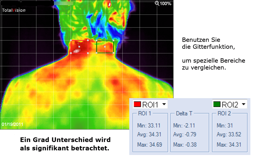 medische_thermografie_rug